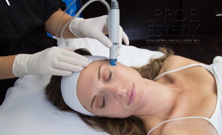 HydraFacial Алмазный пилинг